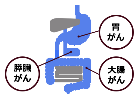 胃がん・膵臓がん・大腸がん